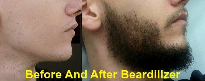 Beardilizer Before After